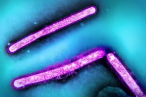 h5n1 bird flu particles micrograph